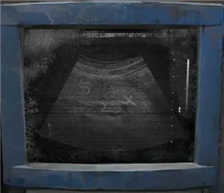 纸嫁衣8千子树第一章攻略 纸嫁衣8千子树第一章攻略